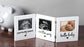 Pearhead Triple Sonogram Keepsake Photo Frame, Baby Keepsake Picture Frame, Gender-Neutral Baby Nursery Décor, Baby's First Christmas Gifts, Baby Gift Ideas, Holiday Stocking Stuffer, White