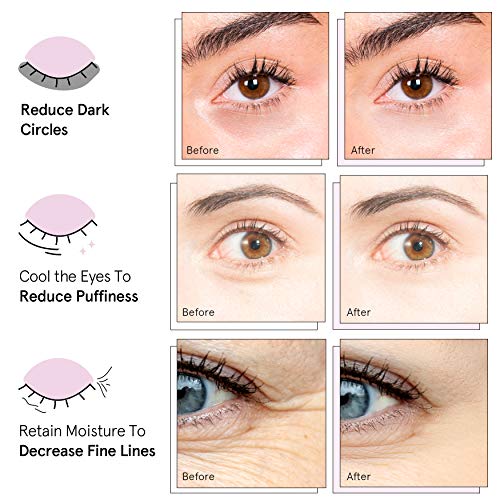 Under Eye Mask - (24 Pairs, Pink) Reduce Dark Circles, Puffy Eyes, Undereye Bags, Wrinkles - Gel Under Eye Patches, Vegan Cruelty-Free Self Care by grace and stella